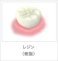レジン(樹脂)