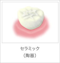 セラミック(陶器)