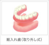 総入れ歯(取り外し式)